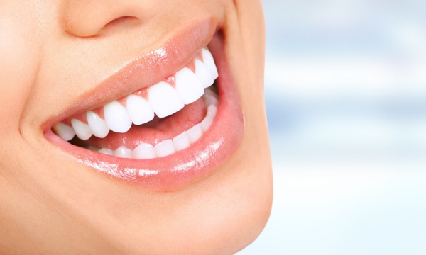Na czym polega bonding w stomatologii?