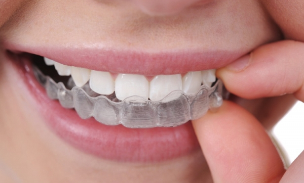 Zadbaj o swój uśmiech - rodzaje aparatów ortodontycznych